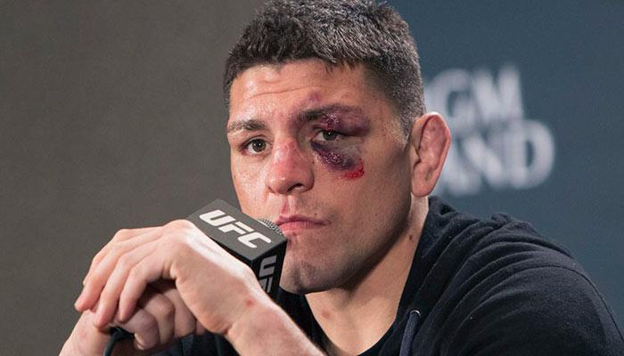 UFC-Fighter-Nick-Diaz-Suspended-5-Years-for-Using-Marijuana